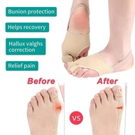 BUNION CORRECTOR TOE BRACE Sarung kaki bunion meluruskan tulang bunion BUNION CORRECTOR TOE BRACE se