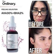 The Ordinary-AHA 30% + BHA 2% Peeling moo 果酸煥膚精華 30ml