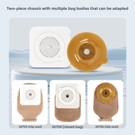 Two-Piece Ostomy Bag Stool Bag Fecal Bag Anorectal Anal Rectal Diversion Ostomy Base Stool Fecal Bag