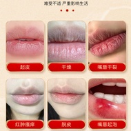 T Thailand Lip Type External Health Balm Soothing Dry Cracked Lip Peeling Peeling Blister Itching Ca