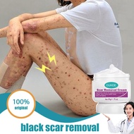 Krim hilangkan parut hitam Hilangkan parut kaki Penghilang bekas luka hitam Mosquito bite scar Keloi