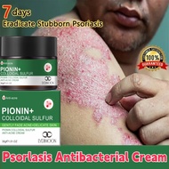 Eczema Cream Psoriasis Ointment Herbal Antifungal Cream Anti BacteriaAnti Viral,Relief Itchy