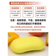 Shanghai Sulfur Soap Body Soap Face Soap Bath Shampoo Bath Sulfur Soap Sulfur Soap Face Soap Clean F