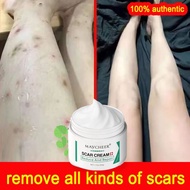 Scar cream, scar fading cream, scar fading cream 50g, dark scar fading cream, scar healing cream, ac