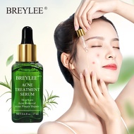 [Miễn phí vận chuyển] Facial Serum Mụn Ẩn Loại Bỏ Mụn Sản Phẩm Chăm Sóc Da Tinh Chất Chăm Sóc Da Mặt