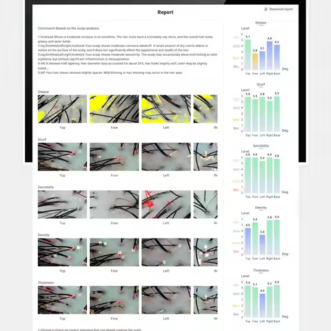 2025Meiboyi AI Intelligent Scalp Analyzer HD Display Skin Analysis Machine Hair Detector Beautys sal
