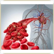 Clopidogrelle%na(l=|s]75mg.s]|.S]100s.B]|.A]COPIDEE