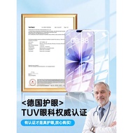 [Dipilih] Platinum Germany Perlindungan Mata Gudang Bebas Habuk Model Baharu Serasi dengan iPhone 17