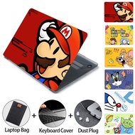 Cartoon Printed Case For 2023 Matebook D14 HUAWEI MateBook D16 D15 D14 14 14s Laptop CASE MagicBook 