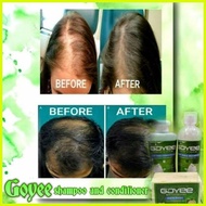 ♞Authentic Goyee Shampoo and Conditioner Hair Care Set Aloe Vera Scalp and Hair treatment Hair grow