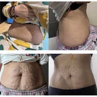 7Fitt Body Shaping Cream *East Malaysia