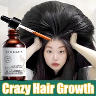 ✨【Fast Effective 】Hair Growth Serum Ginger Hair Tonic 30ML Hair Growth For Men And Women Anti Hair L