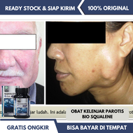 Obat Kelenjar Parotis Obat Tumor Jinak Parotis Obat Kelenjar Air Liur Obat Radang Kelenjar Ludah Oba