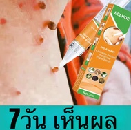 ของแท้ ครีมแต้มหูด หลุดลอกหูดตาปลา ปลอดภัยไม่เจ็บ  ขี้แมลงวัน หูดตาปลาและติ่งเนื้อไฝ พร้อมส่งไทยจัดส