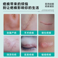 Sunflower Medical Silicone Scar Gel Burn Burn Burn Scars Fade Skin Care Ointment Facial Removal Scar