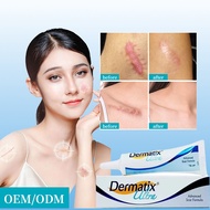 Acne Scar Advance Gel Scar Repair Cream Dermatic Acne Scar Dermatix Scar Reduction Cream 15g
