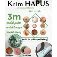 Krim hapus ......ketuat/kutil leher/tahi lalat/biji kolestrol/ready stok/penghantaran pantas