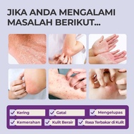 WWSoothing Skin Cream Membantu Memperbaiki Kulit Ekzema Yang Gatal, Melembapkan Kepada Kulit Krim Pe