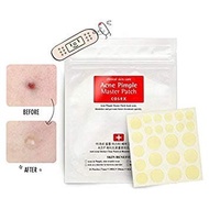 Acne-removing- Cosrx Acne Master Pimple Patch - Acne-Be-Removing