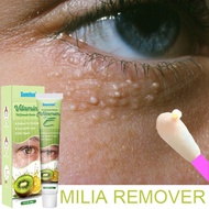 krim milia seed remover vitamin E eye milia cream fat granule syringoma milia remover eye health car