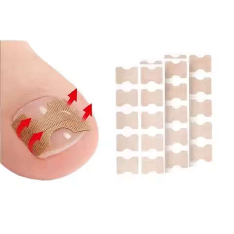 professional Nail Correction Stickers Ingrown Toenail Corrector Patches Paronychia Treatment Recover