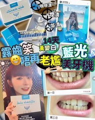 StarSmileClub美國🇺🇸藍光美白牙齒機