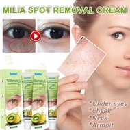 Fat Granules Cream SMilia eed Eye Cream Vitamin E Cream 20g Eye Health Care Milia Eye Fat Granule Syringoma Grease Grains