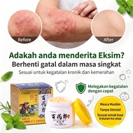 【Beli 3 Dapat 2 Percuma】 Krim BAI YAO LANG, Rawatan Eksim, Kurap & Gatal Kulit