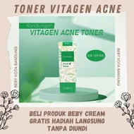 VITAGEN ACNE TONER