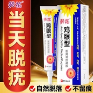 Spread Sunflower Corn Balm Remove Feet Get Hands Corn Foot Soles Calluses Fleshy Foot Nails Corn Bal