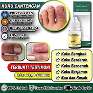 Obat cantengan jempol kaki Obat cantengan Obat cantengan jari tangan Obat cantengan jempol kaki beng