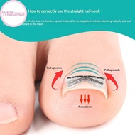 Trillionca 2pcs Ingrown Toenail Corrector Pedicure Recover Embed Toe Nail Treatment Professional Ing
