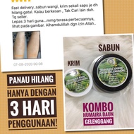 Kombo krim + sabun daun gelenggang (untuk Kurap, Panau, Kudis, Gatal-gatal, Ekzema)