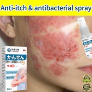 Ubat gatal Ubat kurap Psoriasis spray Ubat eczema Antibacterial Spray Quick Anti Itch Eczema Relief 