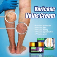 【SooHeal】Varicose Veins Cream 静脉曲张膏 20g/0.705fl.oz | Unclogs blood vessels to relieve numbness as we