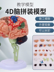 Blue butterfly | 4D Medical Teaching Dissectible Brain Model 31 Parts