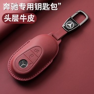 Suitable for Mercedes-Benz Key Cover c-Class c260l New Style McGlae260e300lglbc200