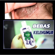 Psoriasis Shampoo Anti Dandruff Shampoo Anti-itch shampoo For Sensitive Scalp Eczema Psoriasis Itchy