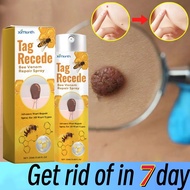 Bee Venom Spray Tag Recede Wart Remover Skin tag remover Ubat ketuat Mole remover Ketuat remover Ski