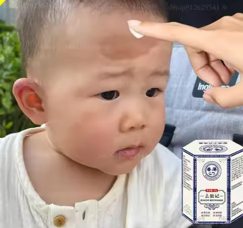 Facial Spots Whitening Freckles Cream Birthmark Removal Cream Skin Dark Spot Remover Melanin Anti-Pi
