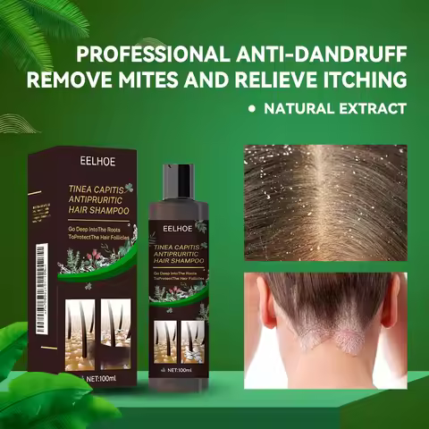 EELHOE Hair Cleaning Shampoo Anti Dandruff Remove Mites Relieve Itching Oil Control Scalp Cleaning R