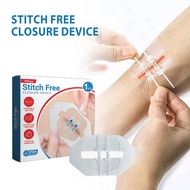 South Moon Wound Closure Care Patch, Mild Skin Friendly, Comfortable Healing Wound Care Sticker