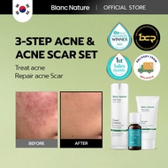 3 Step Acne & Acne Scar Solution (Acne Spot Remover+Pimple Face Cleanser+Acne Scar Treatment Cream)