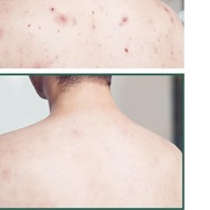 ♦ Somebymi AHA BHA PHA 30 Days Miracle Cleansing BAR / Some by me SOAP ✫