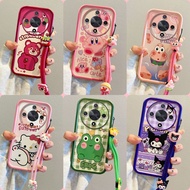 Casing Honor X9d kartun comel phone casing