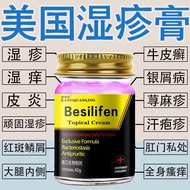 Kang Lingling American Eczema Cream 60g Skin Itching Eczema Eczema Eczema Eczema Eczema External Use