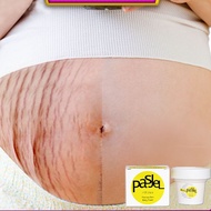Pregnancy obesity wrinkle repair cream, fade care repair cream, fade wrinkle cream