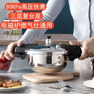 ZzMini Pressure Cooker304Stainless Steel Small Household Induction Cooker Gas Stove Universal Single Small Pressure Cook