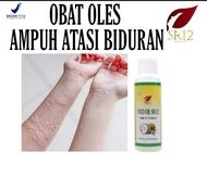 OBAT BIDURAN AMPUH //MENGATASI GATAL-GATAL // MENGATASI ALERGI