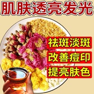 Beauty Removal Beauty Removal Damp Spots Beauty Soaking Water Drinking Suitable for Girls Tea Rose T